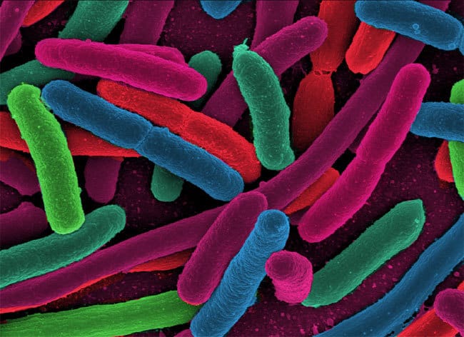 Lactobacillus