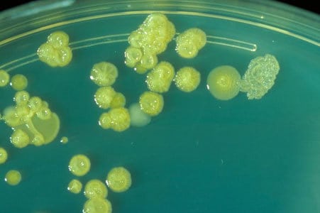 Cronobacter sakazakii - Enterobacter sakazakii
