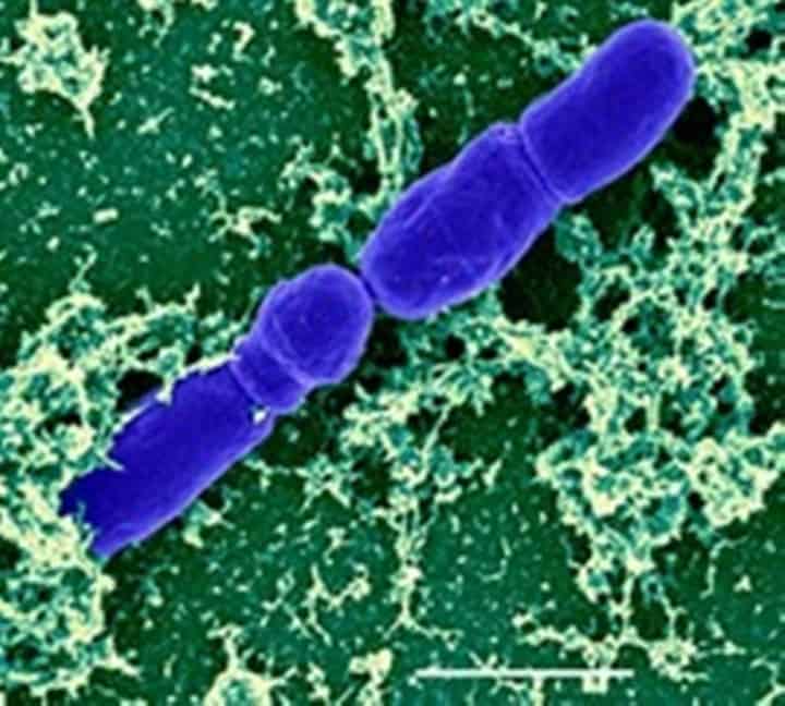 Bifidobacterium infantis - JCM 1222