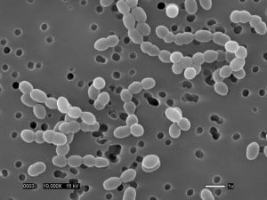 leuconostoc citrovorum