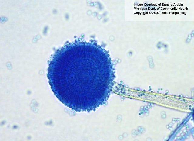 Aspergillus CHỦNG VI SINH VẬT CHUẨN ATCC