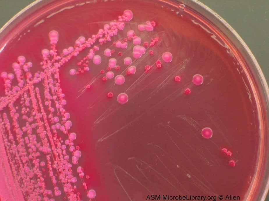 Klebsiella spp