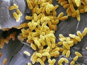 Pseudomonas aeruginosa