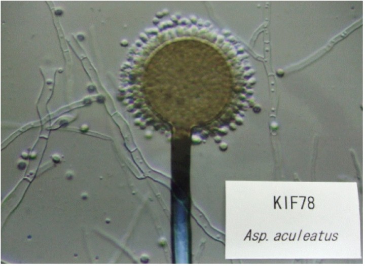 Aspergillus aculeatus NBRC 108796