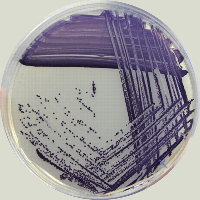 Chromobacterium violaceum NBRC 12614