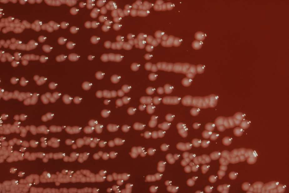 Yersinia CHỦNG VI SINH VẬT CHUẨN ATCC