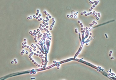 Paecilomyces marquandii