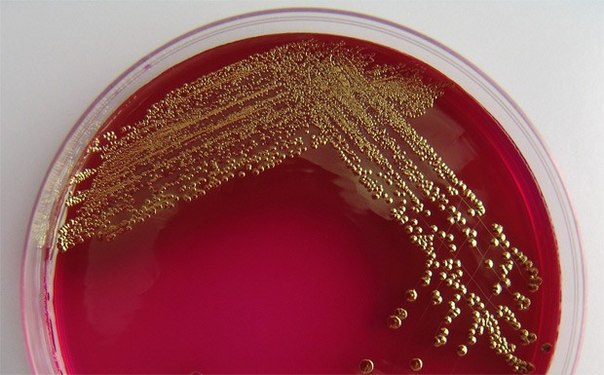 Delftia acidovorans, aerobe, bateria, gold, Cupriavidus metallidurans