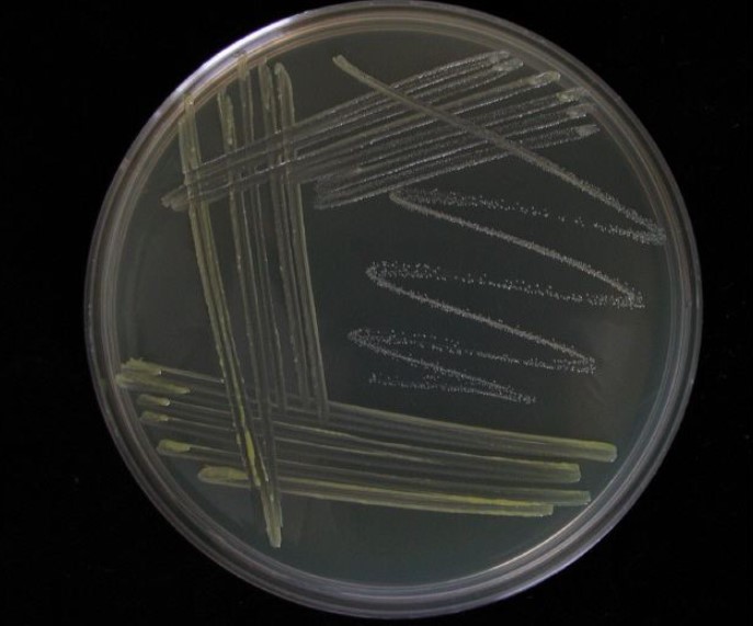 Cellulomonas composti